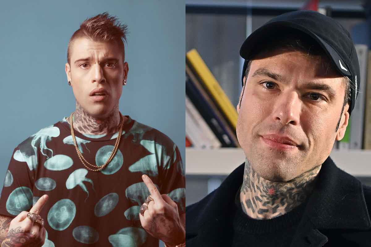 Fedez si è rifatto? La risposta